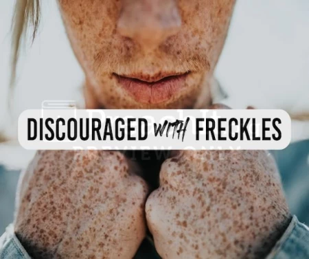 Discouraged With Freckles